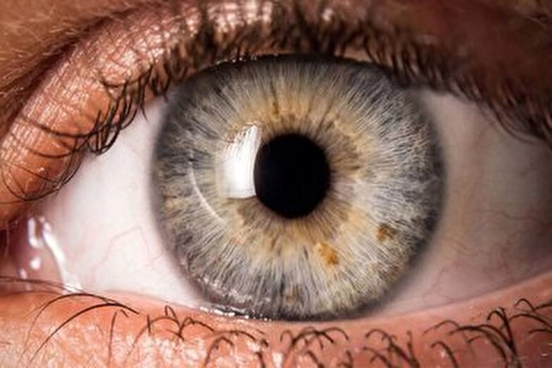 رنگ چشم در مورد سلامت ما چه چیزهایی می‌گوید؟